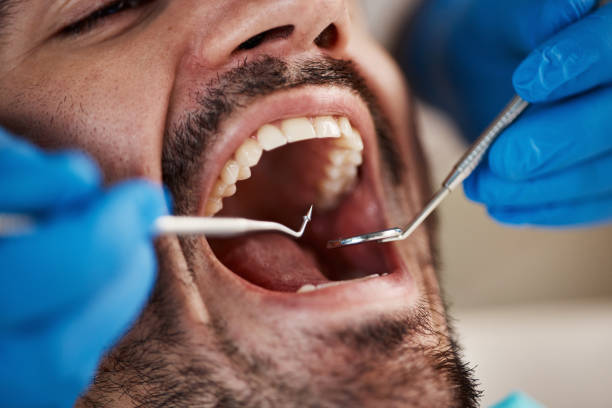 Best Cracked Tooth Emergency Dentist  in Fort Benton, MT