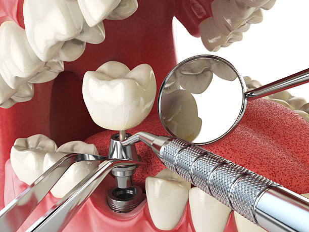 Best Tooth Infection Emergency Dentist  in Fort Benton, MT